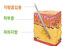 MK성형외과