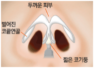MK성형외과