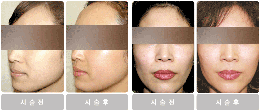 MK성형외과